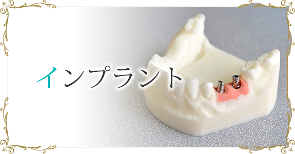 インプラント